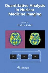 Quantitative Analysis in Nuclear Medicine Imaging (Paperback, 1st)