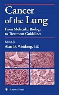 Cancer of the Lung: From Molecular Biology to Treatment Guidelines (Paperback)