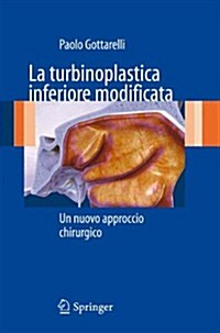 La Turbinoplastica Inferiore Modificata: Un Nuovo Approccio Chirurgico (Paperback, 2012)