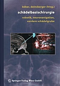 Sch?elbasischirurgie: Robotik, Neuronavigation, Vordere Sch?elgrube (Paperback, 2004)