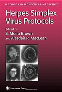 Herpes Simplex Virus Protocols (Paperback)