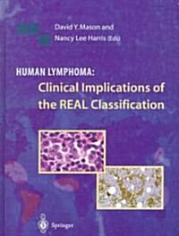 Human Lymphoma: Clinical Implications of the Real Classification (Hardcover, 1st ed. 1999. 2nd printing)