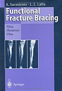 Functional Fracture Bracing: Tibia, Humerus, and Ulna (Hardcover, 1995)