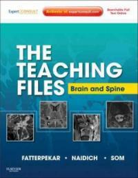 The teaching files : Brain and spine imaging