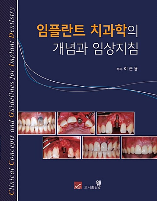 임플란트 치과학의 개념과 임상지침