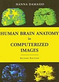 Human Brain Anatomy in Computerized Images (Hardcover, 2)