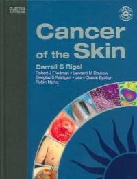 Cancer of the skin