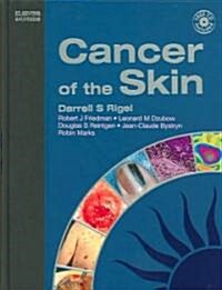 Cancer Of The Skin (Hardcover)