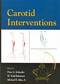 Carotid Interventions (Hardcover)