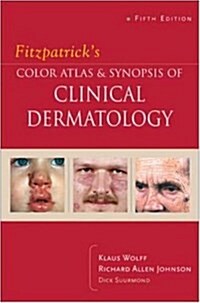 Fitzpatricks Color Atlas and Synopsis Of Clinical Dermatology (Paperback, 5th)