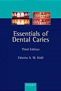 Essentials Of Dental Caries (Paperback, 3rd)