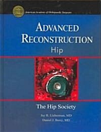 Advanced Reconstruction - Hip (Hardcover)