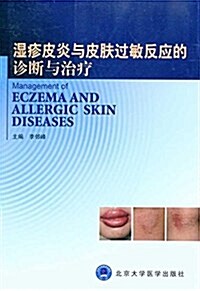 濕疹皮炎與皮膚過敏反應的诊斷與治療 (平裝, 第1版)