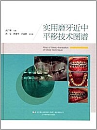 實用磨牙近中平移技術圖谱 (精裝, 第1版)