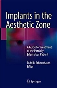 Implants in the Aesthetic Zone: A Guide for Treatment of the Partially Edentulous Patient (Hardcover, 2019)