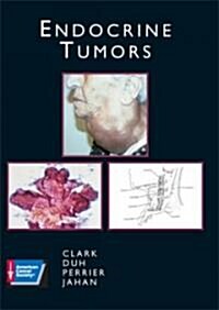 Endocrine Tumors (Hardcover, CD-ROM)