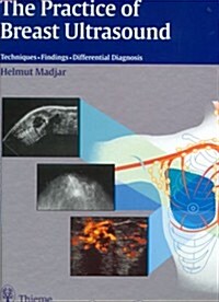 The Practice of Breast Ultrasound (Hardcover)