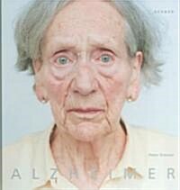 Alzheimer (Hardcover)