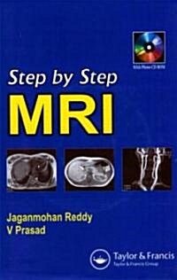 Step By Step MRI (Paperback, CD-ROM, Mini)