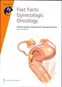 Fast Facts: Gynecologic Oncology (Paperback, 2 ed)