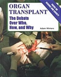 Organ Transplant (Library)