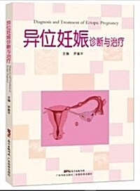 异位妊娠诊斷與治療 (平裝, 第1版)