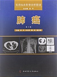 實用臨牀影像诊斷圖谱:肺癌(第2版) (平裝, 第2版)