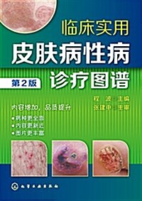 臨牀實用皮膚病性病诊療圖谱(第2版) (平裝, 第2版)