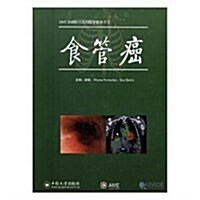 AME科硏時間系列醫學圖书:食管癌 (精裝, 第1版)