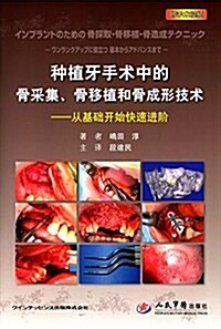 种植牙手術中的骨采集、骨移植和骨成形技術:從基础開始快速进階(附光盤) (平裝, 第1版)