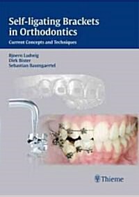 Self-Ligating Brackets in Orthodontics: Current Concepts and Techniques (Hardcover)