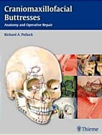 Craniomaxillofacial Buttresses: Anatomy and Operative Repair (Hardcover)