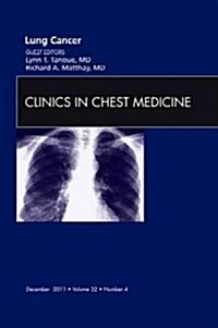 Lung Cancer, an Issue of Clinics in Chest Medicine (Hardcover)