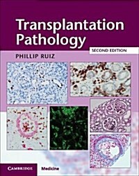 Transplantation Pathology Hardback with Online Resource (Package, 2 Revised edition)