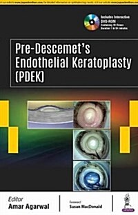 Pre-Descemets Endothelial Keratoplasty (PDEK) (Hardcover)