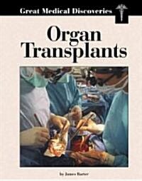 Organ Transplants (Library Binding)