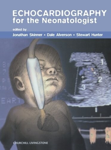 Echocardiography for the Neonatologist (Paperback)