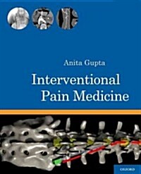 Interventional Pain Medicine (Spiral)