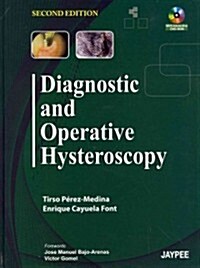 Diagnostic and Operative Hysteroscopy (Hardcover, 2nd, INA)