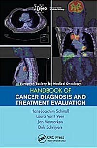 Esmo Handbook of Cancer Diagnosis and Treatment Evaluation (Hardcover)