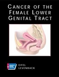 Cancer of the Female Lower Genital Tract (Hardcover, CD-ROM)