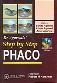 Step by Step Phacoemulsification (Paperback)