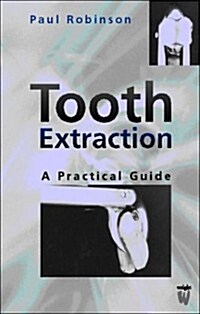 Tooth Extraction : A Practical Guide (Paperback)