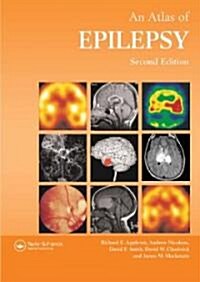 Atlas of Epilepsy (Hardcover, 2nd, Subsequent)