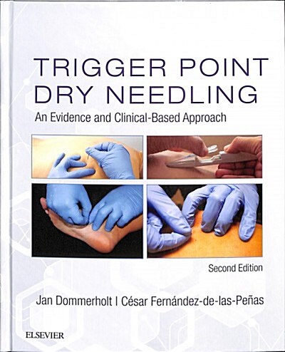 Trigger Point Dry Needling : An Evidence and Clinical-Based Approach (Hardcover, 2 ed)