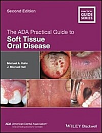 The ADA Practical Guide to Soft Tissue Oral Disease (Paperback)