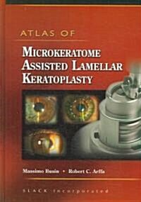 Atlas of Microkeratome Assisted Lamellar Keratoplasty (Hardcover, 1st)