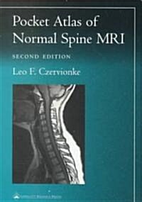 Pocket Atlas of Spinal MRI (Paperback, 2)
