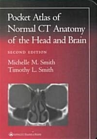 Pocket Atlas of Normal CT Anatomy of the Head and Brain (Paperback, 2)