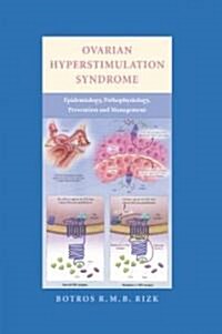 Ovarian Hyperstimulation Syndrome : Epidemiology, Pathophysiology, Prevention and Management (Hardcover)